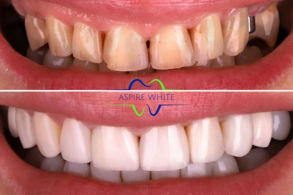 Before And After Results Chesterfield
