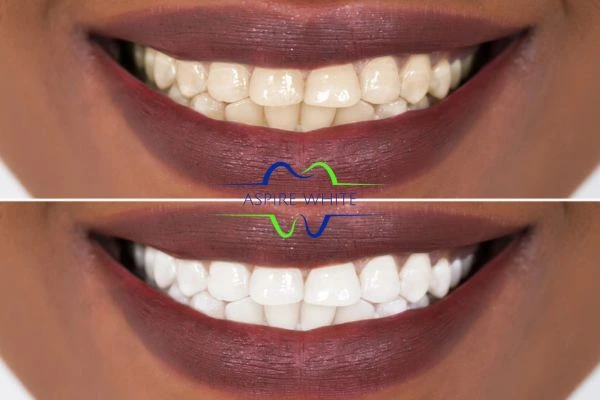 Side-by-side comparison showing before and after results of a cosmetic treatment Chesterfield