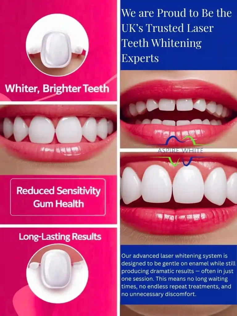 We are Proud to Be the UK’s Trusted Laser Teeth Whitening Experts Chesterfield